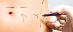 cirurgia-plastica-porto-seguro-1382373741